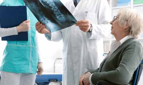 Osteoporose: Vamos promover a qualidade óssea dos idosos (e a nossa)!